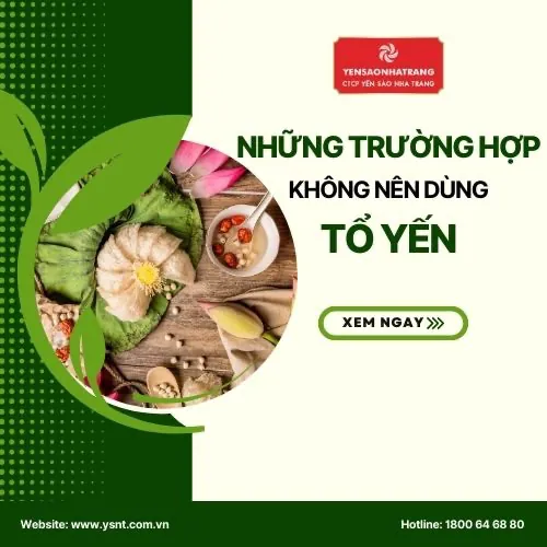 [GÓC TƯ VẤN – SỐ 14] BẠN THẮC MẮC, CHÚNG TÔI TRẢ LỜI